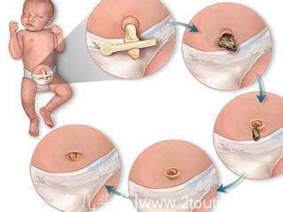 新生儿脐带如何护理 这几个细节不能忽视
