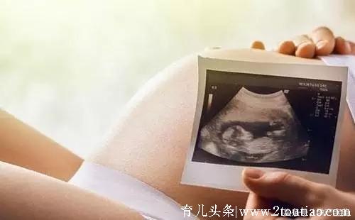 怀孕多久知道胎儿性别，教你一招看检查单就知道