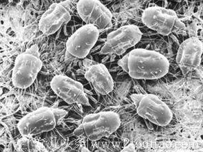 孩子身体发现数千条寄生虫，常吃“它”可长点心