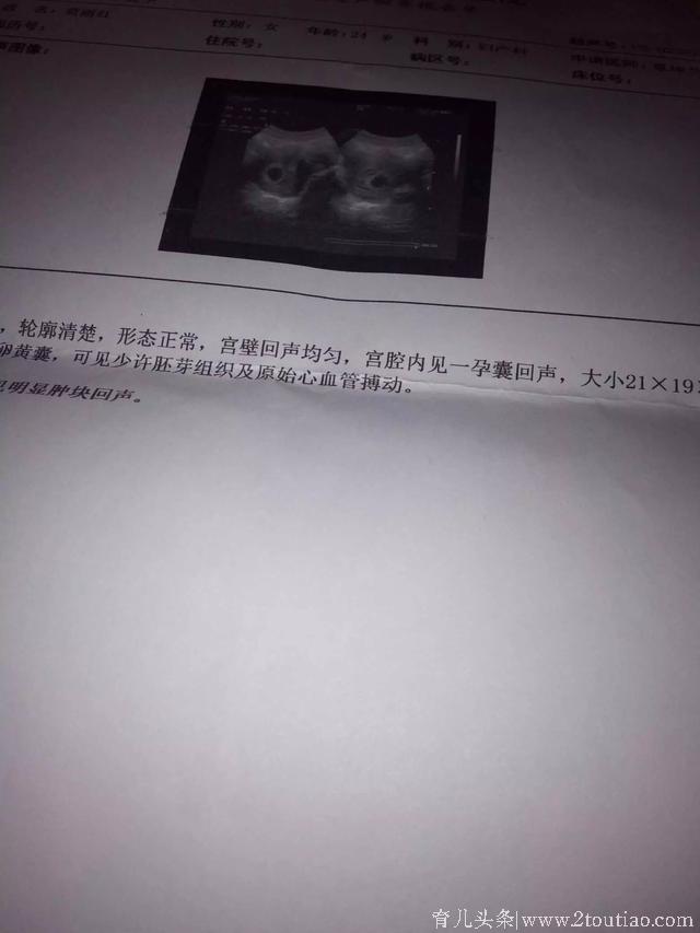 二胎顺产7.6斤女宝一枚，儿女双全，记录顺产过程，附孕期症状