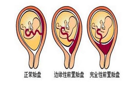 宝宝生下来胎盘怎么处理？胎盘有什么功效