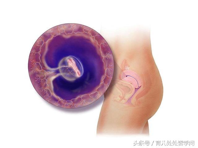 为何腹中胚胎会停止发育？该如何去预防？