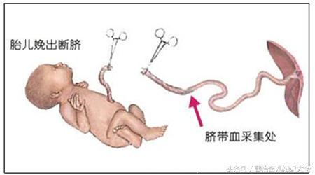 产下双胞男宝胎盘却出不来，护士慌乱剪断脐带，医生被吓出冷汗！