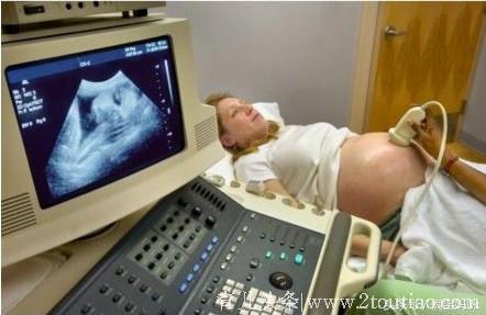 孕期b超检查能否判断胎儿是否正常