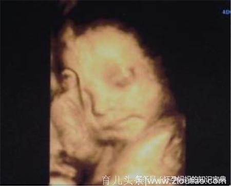 孕妈妈如何通过四维彩超对比图辨别胎儿性别