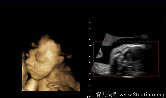 怀孕5个月婆婆说我肚子太平，B超看到胎儿的头时，医生不说话了