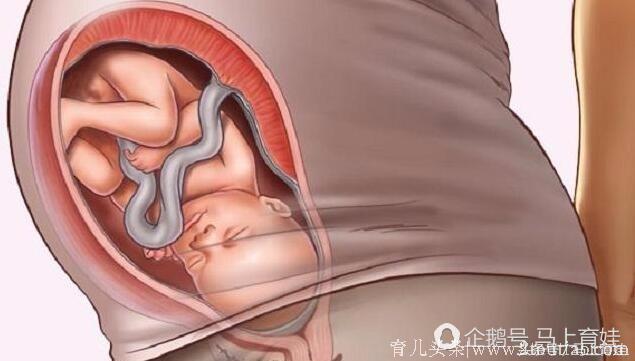 胎儿入盆啥感觉？4个信号告诉你要生了！胎儿入盆后要注意什么？