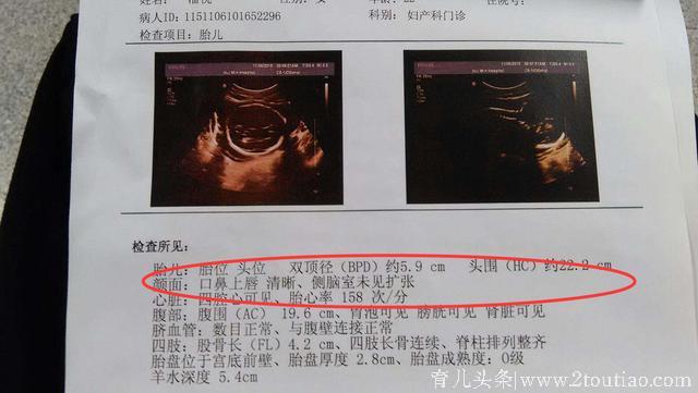 怀孕三个月，看B超单的这些数据，是男是女早知道？