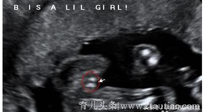 孕4月后如何通过B超来看男女的性别和B超室的暗语