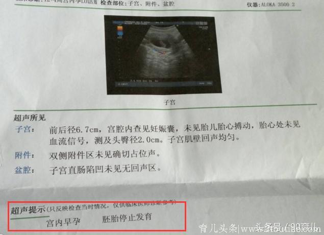 孕检没问题却生下畸形胎儿，产妇家属大闹医院，医院该负责吗？