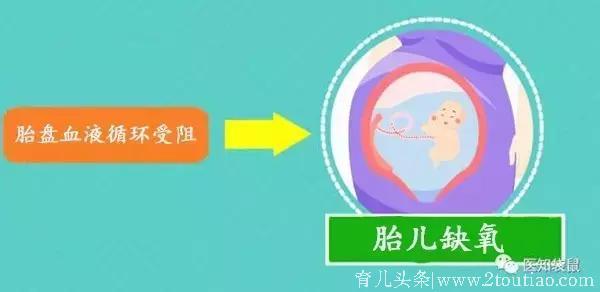 生孩子越快越好？北大医院医生告诉你：急产有多可怕！