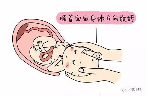 生孩子越快越好？北大医院医生告诉你：急产有多可怕！