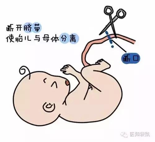 生孩子越快越好？北大医院医生告诉你：急产有多可怕！