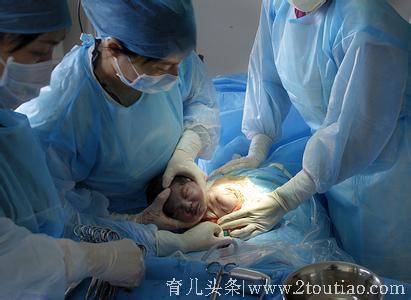 一次违反原则的手术，却救了肚子里胎儿的性命