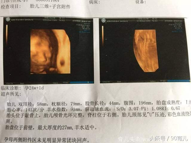 知道我怀了女儿，婆婆顿顿咸菜，生出2300克孙子她后悔了