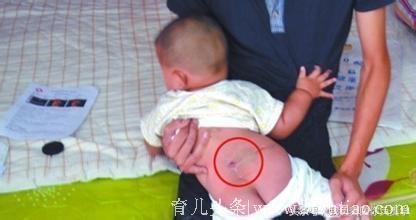 30岁女子生下女儿带“尾巴”，医生看后惊出一身冷汗！