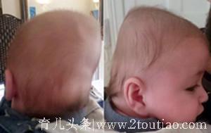 宝宝3个月，小脑袋越睡越歪，老中医教你一招让宝宝睡出漂亮头型