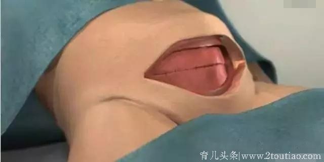 剖腹产要挨几刀？缝多少层肚皮？看完心疼女人一万遍！