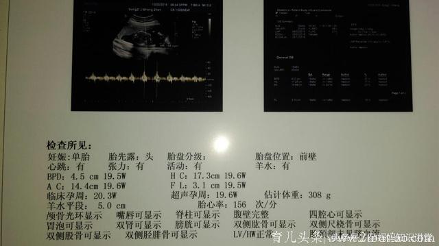 学会这八招，宝宝的性别算出来