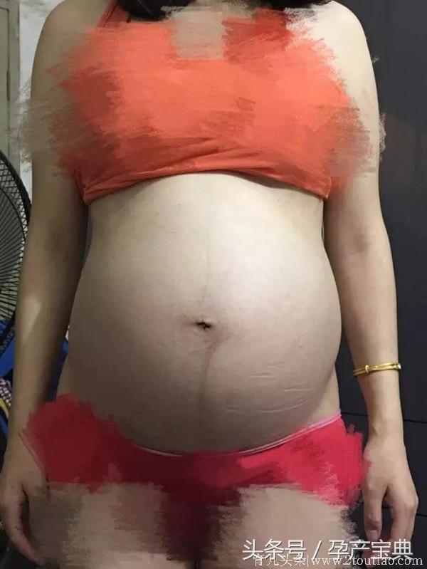 顺产健康男宝，孕期肚子上竟长出这么多毛，胎梦很准！