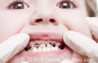 7岁男童牙齿烂光，这不是小事，父母懒惰可能会毁孩子一生！