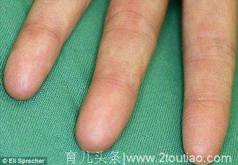 宝宝手指上有几个“斗”？“指纹与智商”的科学解释
