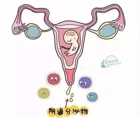 孕期分泌物，什么颜色才是正常的