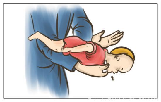 孩子卡住喉咙了别硬拍，学会这个方法，能救孩子一命