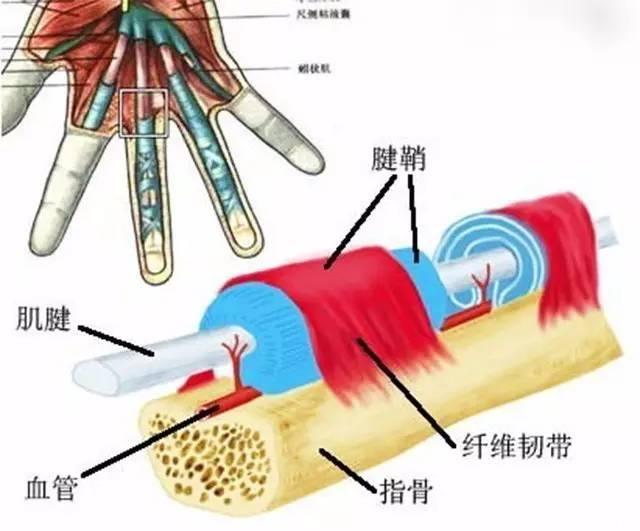 手指疼难伸直，是腱鞘炎吗？