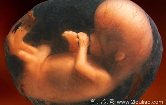 宝宝的“脐带血”到底要不要存？临产前你是否也有过这样的纠结？