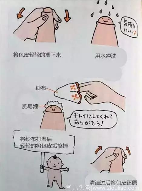 致家长：男孩包皮过长要不要割？