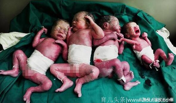 孕妇喜怀三胞胎，第3个孩子出生后却发生了始料未及的一幕