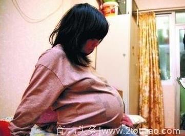 怀孕两个月肚子却大的走都走不动，检查结果竟让人吃惊