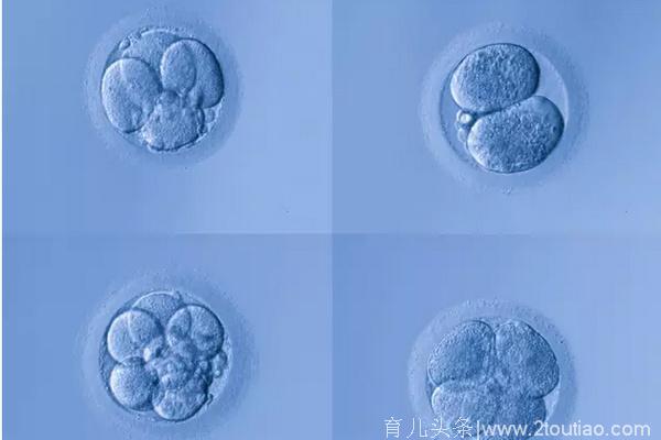 鲜胚移植和冻胚移植该如何选择？