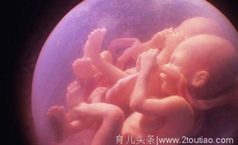 3胞胎产妇分娩 抱出第3个后 又有意外发现！