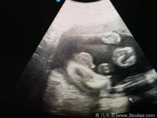 怀孕7个月B超显示男宝 总结了12条孕期症状，和自己对第一下就知道男女了！