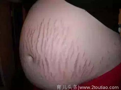 Angelababy产后素颜出席活动，身体这一部位足以看出她生过孩子，网友指责黄晓明