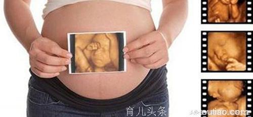 轻松教你分辨B超单上的这3个秘密，证明孕妈腹中怀的是男宝！