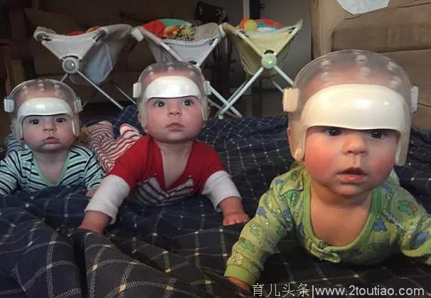 刚出生的三胞胎就戴头盔，为他们取下的一幕让人落泪！