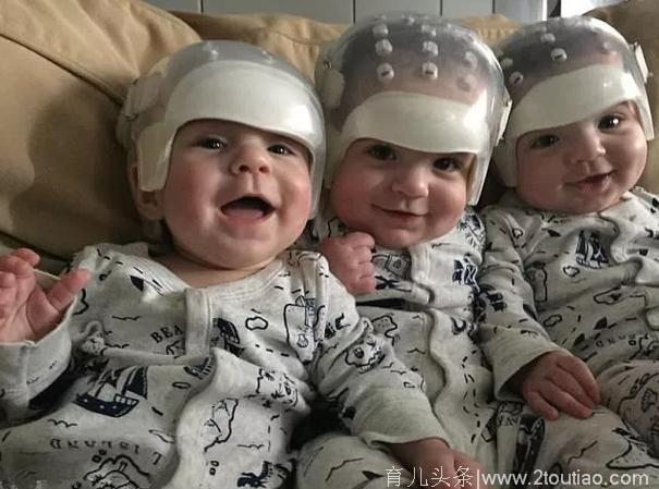 刚出生的三胞胎就戴头盔，为他们取下的一幕让人落泪！