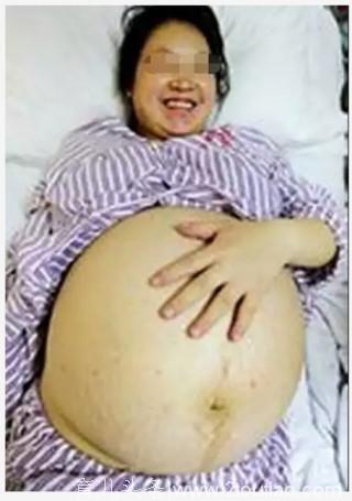 24岁的女孩怀孕3个月肚子突奇的大，护士检查后称不敢接生，从来没遇到过这种情况