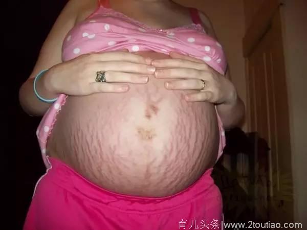 宝妈心酸自述：怀孕以后，我觉得自己就是将水过滤成尿的过滤器！