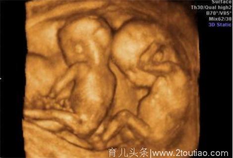 十月怀胎生下双胞胎男孩，助产士报喜后，婆家人没一个开心