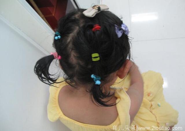 3岁女孩突然大量掉头发，送医后妈妈怒扇自己耳光