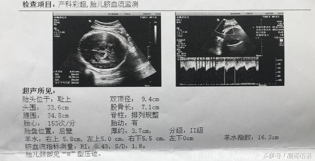 孕期6次彩超全分享：双顶径、股骨长、胎心率，是否有规律可循