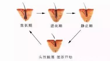 “满月头”不是想剃就能剃，尤其是这3种情况！