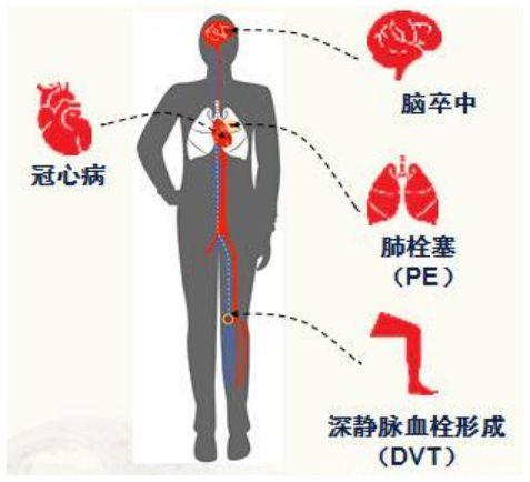 妇产科医生：别掉进产后坐月子的六大误区，坐个假月子