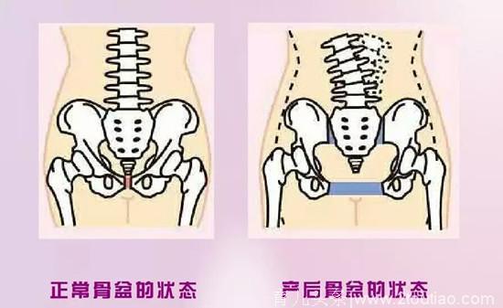 妇产科医生：别掉进产后坐月子的六大误区，坐个假月子