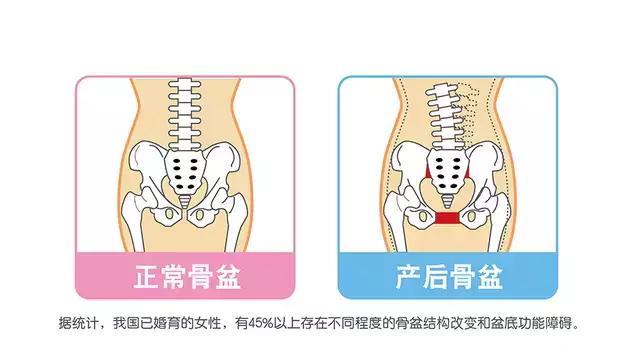 产后恢复不难，月子里坚持这十步，42天不白熬不落病，受益一生