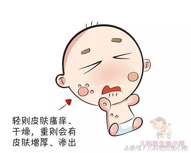 宝宝湿疹反反复复，怎么控制它？医生：做到这3点就容易得多